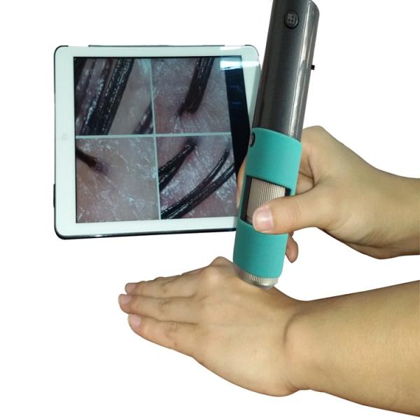 HD 300 Megapixel Skin And Hair Analysis Machine 600X Wireless Hair Scanner