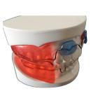 Dental Orthodontic Appliances Simple Install HighTech Biological Material
