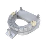Long-Lasting Low Water Absorption Permanent Crown Resin for Porcelain-Filled