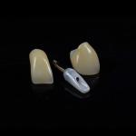 ODM Full Arch Zirconia Implants Bridge Zirconium Implants Holistic Dentistry