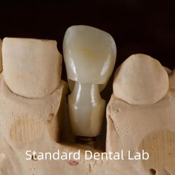 China Dental Implant Tibase Zirconia Abutment Titanium Accuracy Customized factory