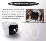 576 dots Slimming Machine Weight Loss Body Anti Cellulite Liposonixing Lipo
