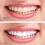 Natural Coconut Charcoal Teeth Whitening Powder To Remove Tooth Stains