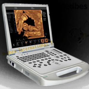 China 4D Baby Portable Medical Color Doppler Ultrasound Machine factory