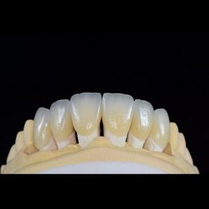 China Dental Lab Teeth Feldspathic Porcelain Veneers Custom Shaped factory