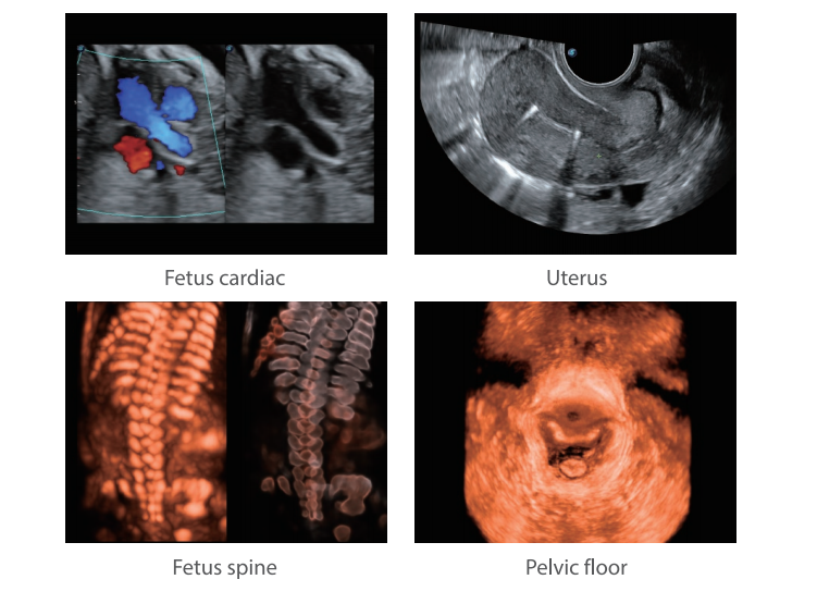 Cardiovascular Sonoscape P50 Ultrasonido Doppler Ultrasound Machine