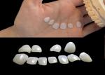 Ultra Thin Ceramic IPS EMAX Veneer Stain Resistance For Esthetic Restorations