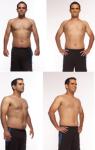 Cryolipolysis slimming equipment cryolipolysis slimming machine cryotherapy fat