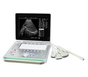 China Portable ultrasound machine Laptop Ultrasound machine SU-7S with CE factory