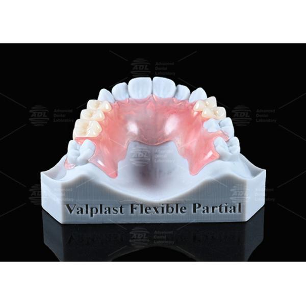 China Natural Looking Valplast Partial Denture Longevity Highly Resistant To Fractures factory
