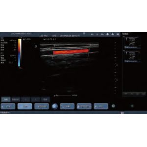 Compact Lightweight Hand Held Doppler With Max 8 Hours Continuous Working