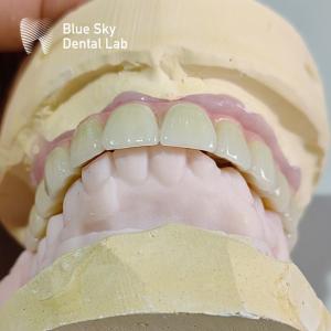 China Implant Operation Cases / Implant Procedure Cases for Diverse Implant Choices and Sterilizations factory