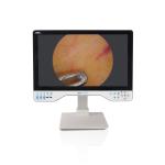 24 Inch Laparoscopic Monitor 4K UHD Endoscope Camera System Surgical LED With