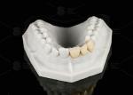 Durable Hypoallergenic EMAX Bridge Extreme Esthetics Emax Dental Bridge