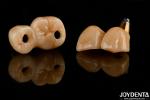 Restoration Of Missing Teeth Implant Crown and Bridge Safe For Oral with