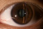 3.5" Ophthalmology Diagnostic Equipment For Glaucoma Diabetes