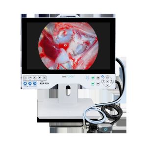 China 15.6 Inch Rigid All in One Endoscope Camera System 1080P Medical Grade with Local Playback Function factory