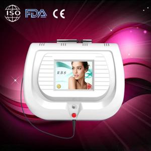 China 2014 the most popular spider veins removal machine with 30MHz RBS high frequency factory