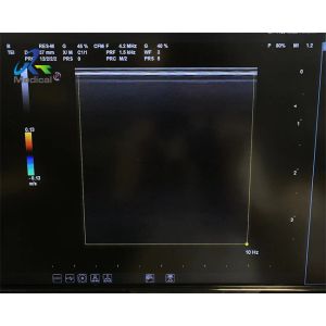 Biosound Biosound SL1543 Linear Array Ultrasound Probe Repair Replace Lens And