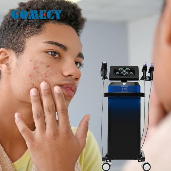 GOMECY Fractional Skin Treatment with Microneedle RF Machine for Safe Wrinkle