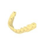 Dental Bridge Photosensitive Resin Non Toxic Temporary Resin Crown