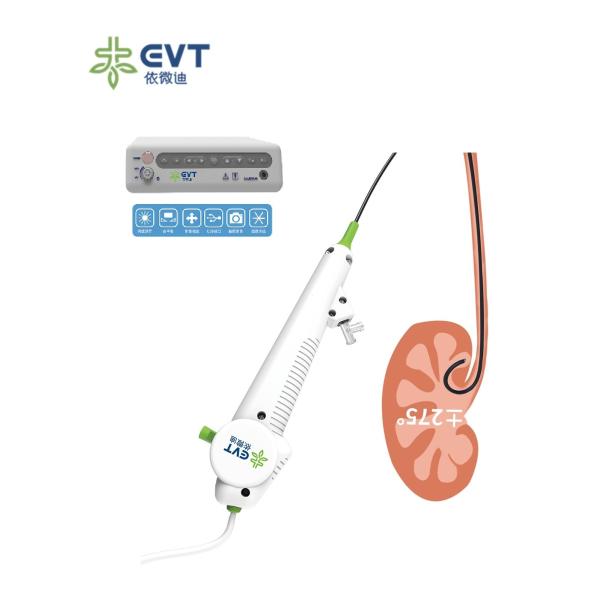 Precision Control Flexible Digital Ureteroscope 270° Deflection And 670mm