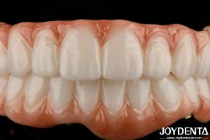 China Long Lasting Titanium Bar Zirconia Hybrid Bridge Natural Looking Aesthetics For Restoring factory