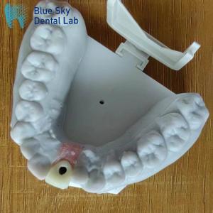 China Steam Sterilization Single Implant Crown Smooth Surface Dental Implant Crown factory