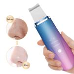 Wireless Ultrasonic Facial Spatula , Ion Cleaner Facial Skin Scrubber