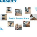 ED Shock Wave Therapy Machine , Pain Relief EMS Shockwave Machine
