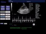 Hospital Diagnostic Machine Full Digital 4D Color Doppler Ultrasound Scanner