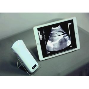 China Windows Pocket Ultrasound Scanner Machines Electronic Phased Array on sale