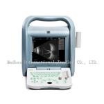 best selling ab scan a cheap ophthalmic ultrasound Eye machine