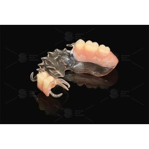 China Vertex Clear Flexible Partial Virtually Unbreakable Low Allergy Risk Full Partial Denture factory