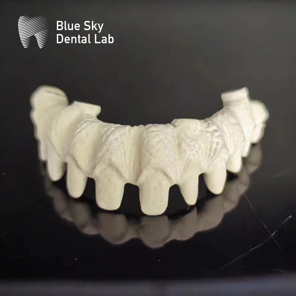 Pure Titanium Metal Frame Dental Malo Bridges For Silver And Gold Frame Color