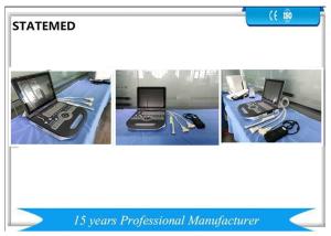 China Human Color Doppler Ultrasound Scanner With 80 E / 128 E High Definition Image factory