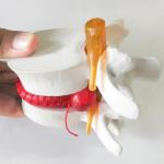 3D Vertebrae Cervical Spine Model 1.5X Lumbar Vertebral Spine Herniation