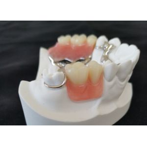 Custom Smooth Surface CAD CAM PFM Crown Bridge High Definition