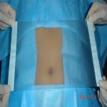 PE Single Use Surgical Incise Drapes Blue Nonwoven 3 Layers