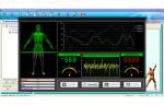 Hospital Body Analyze Equipment Quantum Magnetic Resonance Health Analyzer