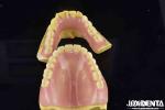 Unleash Potential Of Your Dental Practice Acrylic Denture Finish With Diverse