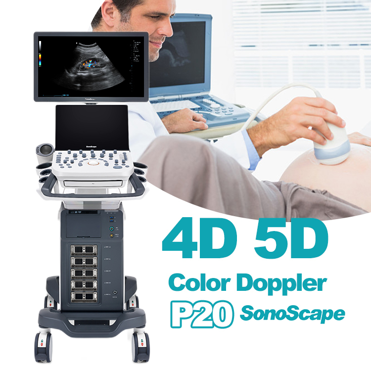 High Quality Sonoscape 4d 3d Ultrasound Machine Ultrasonido Veterinariy Human