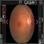 High Resolution Digital Fundus Camera Red Free Retinal Imaging