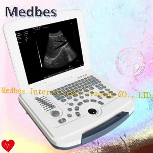 China Hospital 15 TFT Color Medical Portable Ultrasound Machine factory