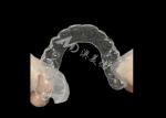 Orthodontic retainer　Essix Retainer Simple And Versatile Correction