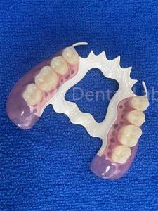 China Stain Resistant Removable Dental Partials Stable Replace Missing Teeth Prosthesis factory