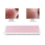Wrinkle Red Light Therapy Panel