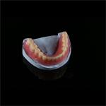 Removable Smile Full Acrylic Complete Denture Customizable