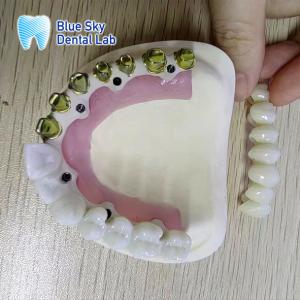 China Silver Gold Pure Titanium Metal Frame Dental Gold Plated Metal Frame Partial factory