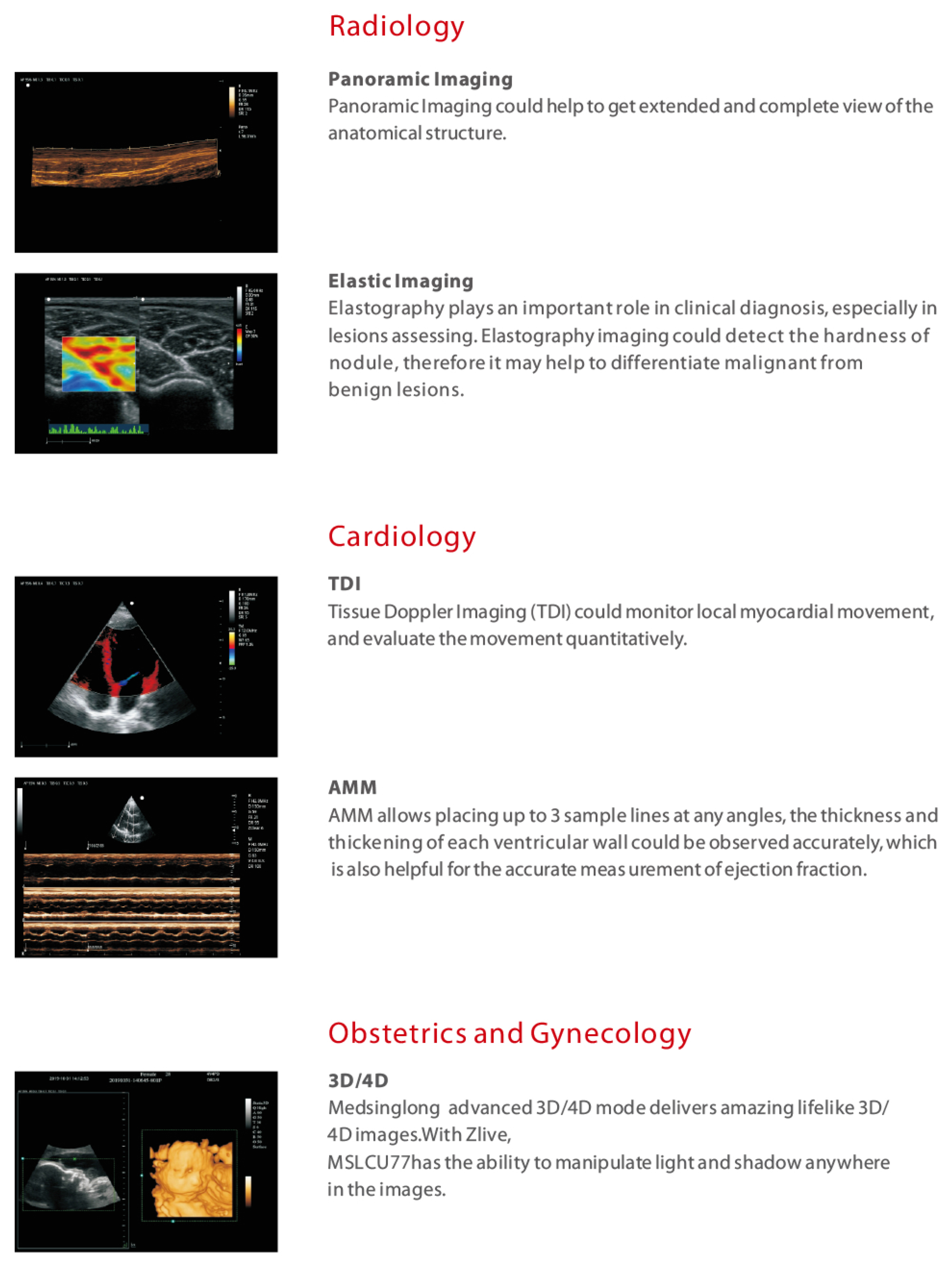 Best Price CW, TDI , PDI Handheld Portable Ultrasonido 3D 4D Veterinary Doppler Ultrasound Machine